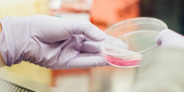 Person with a petri dish
